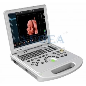 3D/4D/5D Laptop Color Doppler Portable Ultrasound Scanner