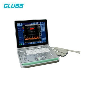 15 inch LED Screen MS-U10 color doppler 3d/4d ultrasound scan machine system