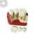 Import dental implant model medical restoration model implant teeth model from China