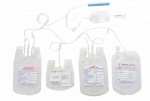 Multiple Certificates Qualified Leukocyte Filter with Blood Bag Medical Products
