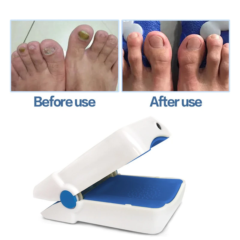 New Products 2021 Nail Fungus Laser for Toenail Fungal Treatment lllt 905nm Ringworms Physical Therapy Equipments