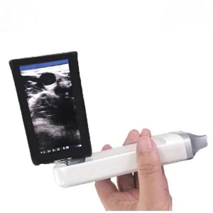 Built-in Screen Mini-Linear Ultrasound Vsono-BML1