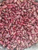 High Quality Purple Speckled Kidney Beans