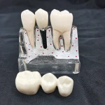 Dental Practice Transparent Implant Model Demo Overdenture Restoration model  medical simulators for training