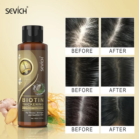 Amazon Hot Sale Sulfate Free Anti Hair Loss Growth Biotin Shampoo Set Biotin Shampoo And Conditioner