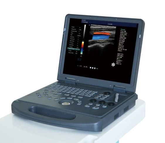 Clear Imaging 3D/4D Portable Color Doppler Echocardiography Ultrasound scanner machine price for Pregnancy