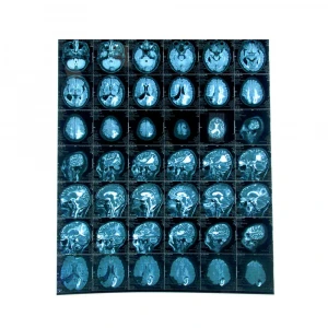 Laser printing blue dry medical film substitute agfa x-ray film for x-ray equipment