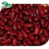 top quality british type red kidney bean