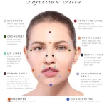 Botox 100iu and 200iu for sale