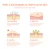 Import Custom Private Label Oem Skin Care Acne Wound Pimples Sticker 25 Patch from China