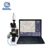 High accuracy sperm analyzer/semen analysis CASA machine software