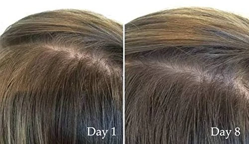 60ML Diminishing Loss Grow Longer Thicker Improve Dry Brittle Polypeptide Hair Care Serum Growth Hair Treatment