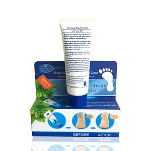 Herbal Ingredient Free Foot peel for cracks dry skin Natural Herbal Foot Care Cream
