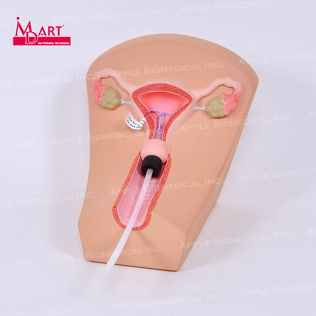 Medical equipment IUD insert surgical training model with uterus model