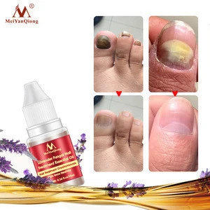 Lavender Fungal Nail Treatment Nail Protector Essential Oil HerbTreatment Infection Paronychia Nail Repair Essential Oil