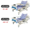 Five Functions Luxurious Motor System Medical Hospital Beds