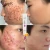 Import Mango Repair Acne Cream Anti Acne Spots Acne Treatment Scar Blackhead Cream Shrink Pores Whitening Moisturizing Face Skin Care from China