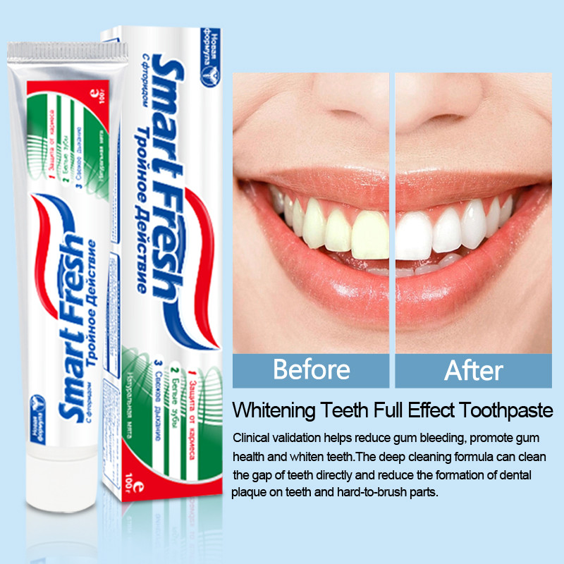 Buy Smartfresh Toothpaste Wholesale Stain Removal Oral Refreshing ...