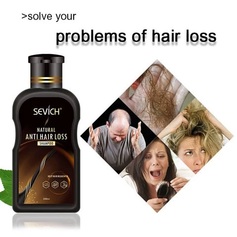 Factory High Quality hair loss treatment shampoo Premium Hair Growth Supplement Reduces Hair Loss shampoo
