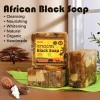 OEM Ovilz Natural Face Body Lightening Rashes Acne Treatment Blemish Dark Spot Remover Organic African Black Soap