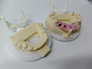 Dental UV resin material, dental model resin, dental guide plate resin, 405nm wavelength resin