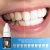 Import BREYLEE Private Label Teeth Whitening Serum Oral Hygiene Cleaning Serum Tooth Bleaching Removes Plaque Stains Teeth Whitening from China