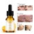 Import Capsule For Black Woman From Korea And E Natural Serum Vitamin C Beauty from China