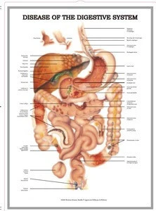 disease of the digestive system poster