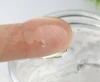 OEM Herbal Cucumber Acne Scar Removing Face Gel