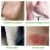 private label urea dead skin removal cracked heels exfoliating peeling whitening softening hand and foot cream