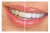 Import SH-66 hot blue led light teeth set tooth bright / tooth whitening kit / teeth whitening from China