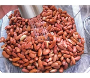 Dried and Raw Dark Red Kidney Sugar Bean/red kidney bean dry pinto beans