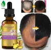 Wholesale Private label natural organic Hair growth oil Hair Regrowth serum Hair care essential oil