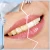 Import Patented Safe Dental Care 2021 Professional Beauty Home Use And Teeth Whitening Kit Private Logo from China