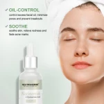 Wholesale Hyaluronic Acid Face Oil Control Softer Contain Niacinamide Serum