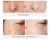 best dark spot corrector natural skin whitening freckle blemish lightenig dark spot removing cream