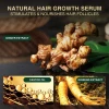 Ginger Hair Growth Oil Hair Growth Serum 30 ml Germinal Essential Oil oil saw palmetto supplement hair growth spray
