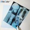 Low Fog 8 x 10 Inch Blue PET Inkjet Medical X Ray Film For Epson Printer