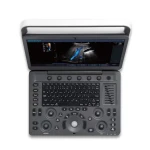 Sonoscape ultrasound machine E1V