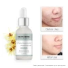 High Quality Skin Care Repair Reduces Pores Balances Oil Fine Lines Niacinamide Face Serum