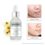 High Quality Skin Care Repair Reduces Pores Balances Oil Fine Lines Niacinamide Face Serum
