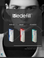 Redefill 1ml HA Filler for Natural Lip Volumizing and Facial Contouring