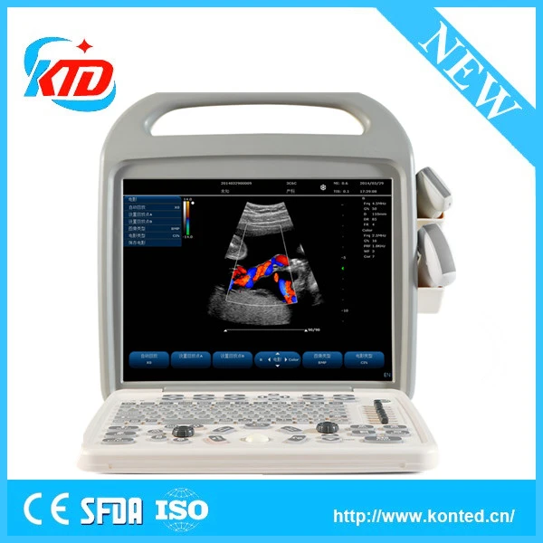 CE Approved Ultrasonic Diagnostic Medical Equipment Vascular Doppler Ultrasound