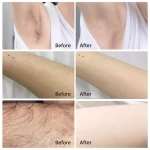 Factory Price Hair Removal Cream for Women Depilatory Cream Effective 10 Minute Powerful
