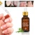 Import Wholesale Natural Herbal Nail Care Oil Fungal Treatment Anti Blossom Cuticle Repair Nail Serum from China