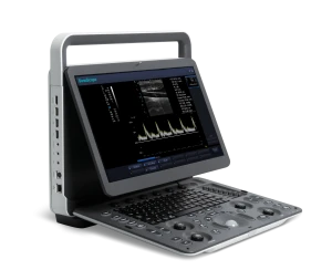Portable color doppler ultrsound machine of Sonoscape Ultrasound scanner