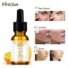 10ml Private Label Pure Organic 20% Vitamin C Facial Skin Care Brightening Lightening Hyaluronic Acid Whitening Serum For Face