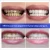 Import BREYLEE Teeth Whitening Powder Toothpaste Dental Tools White Teeth Cleaning Oral Hygiene Toothbrush Gel Remove Plaque Stains 30 from China