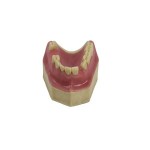 biological dental implant study plastic model