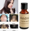 Andrea Hair Growth Serum Oil Herbal Keratin Fast Hair Growth Alopecia Loss Liquid Ginger Sunburst Yuda Pilatory Oil